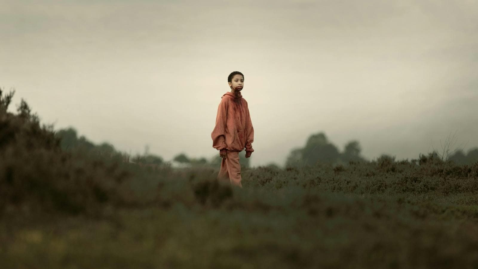 Young child with shaved head stands in isolated surrounds with blood around mouth